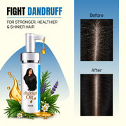 Key scalp-care ingredients used in Champi Oil EXO Dandruff Treatment Oil